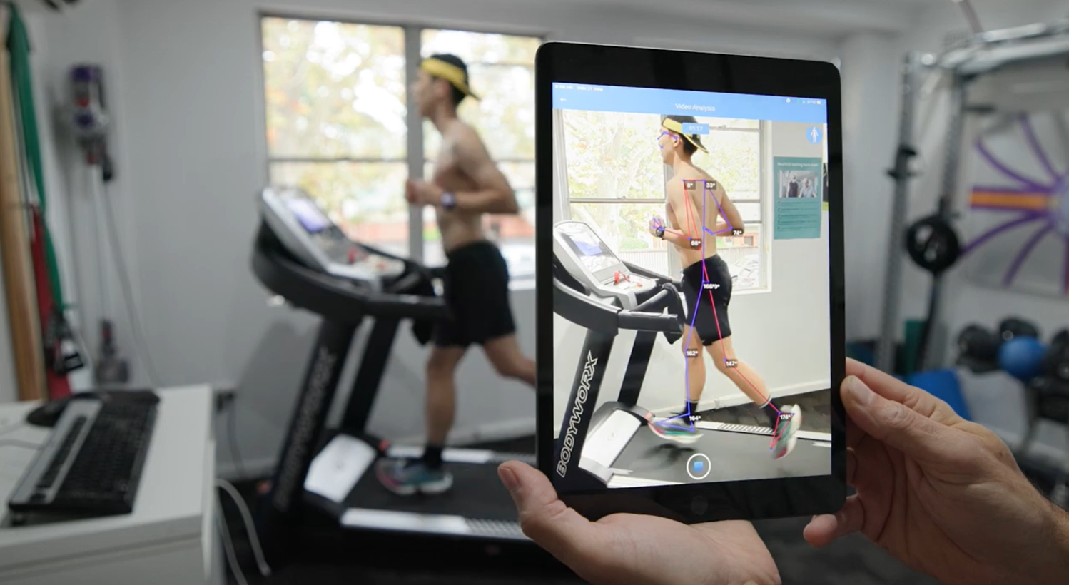 Running gait analysis and biomechanical assessment using treadmill video analysis at Cammeray Chiropractic & Performance Centre, Sydney