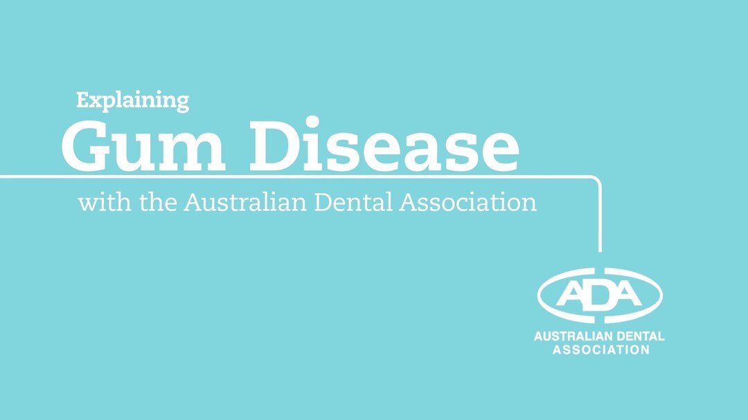 Explaining Gum Disease with the Australian Dental Association 👨&zwj;⚕️🦷