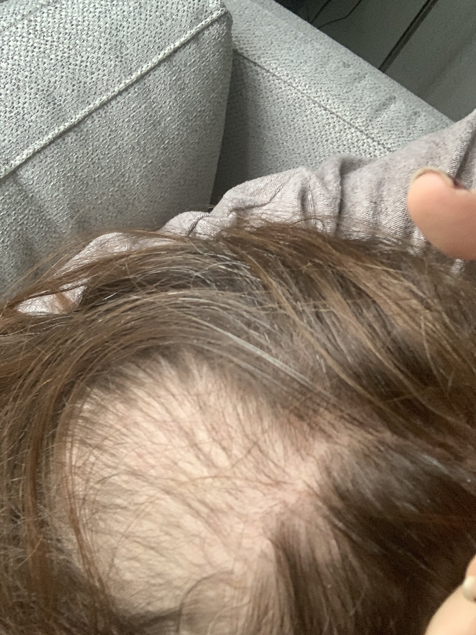 Hair post cancer.. — Kate Lodge Hair