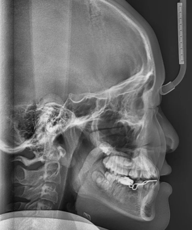 Before treatment