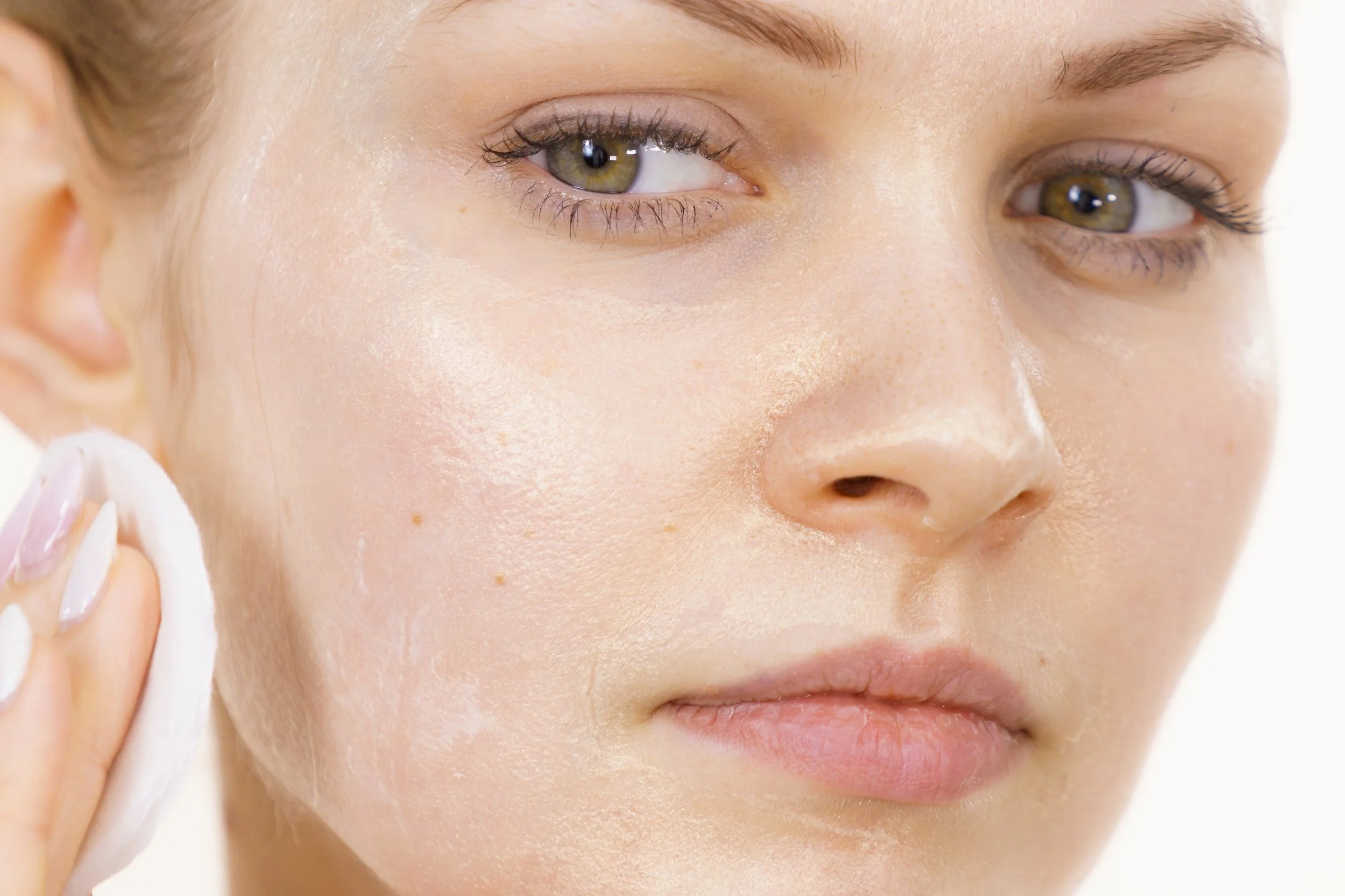 From Breakouts to Repair Mode: How to Clear Acne Scars and Fade Post-Acne Marks