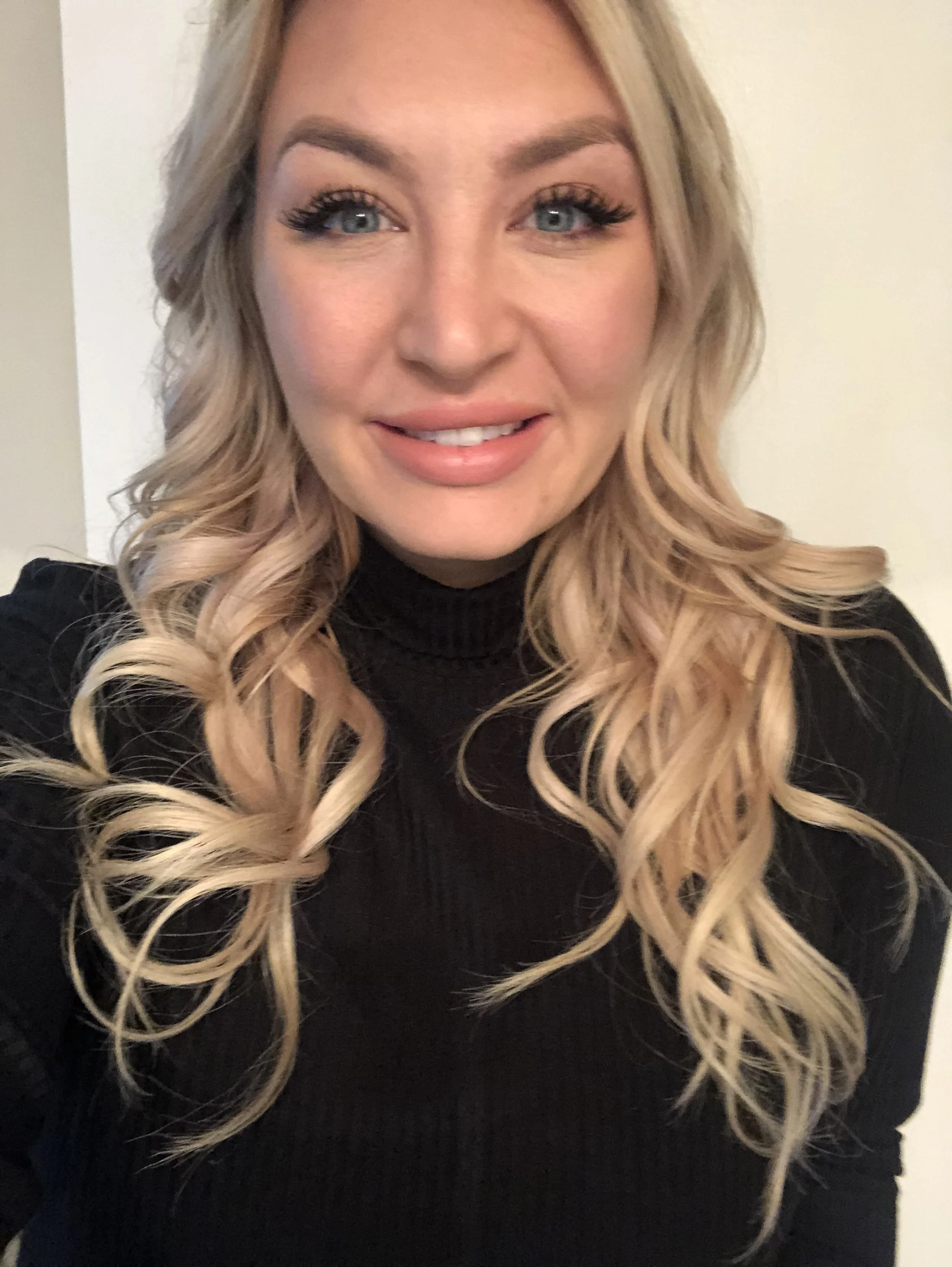 TMJ Tox Examples — The Sweet Spot