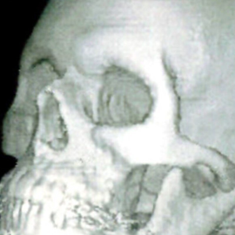 Bonnie's skull (Copy)