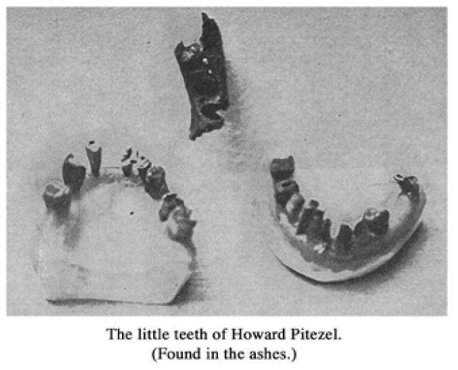 Howard-Pitezel-teeth.jpg