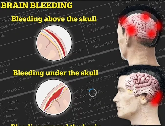 headinjuries2.png