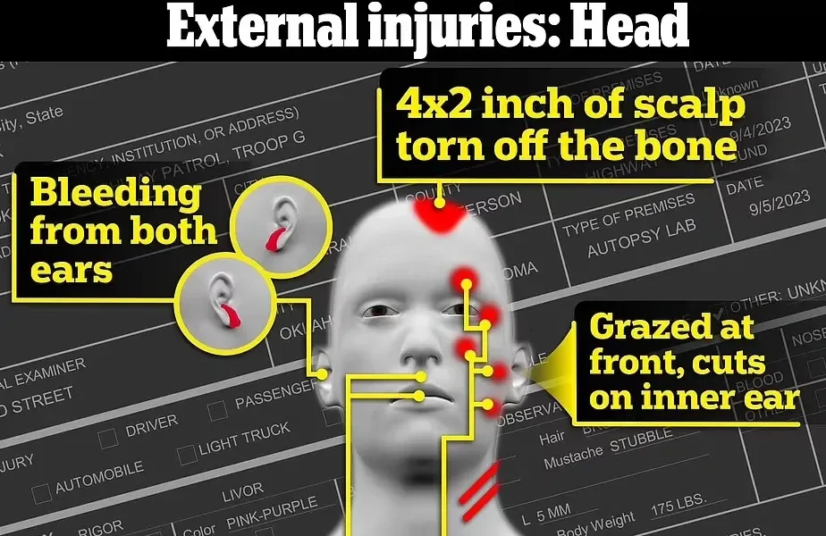 head injuries.webp