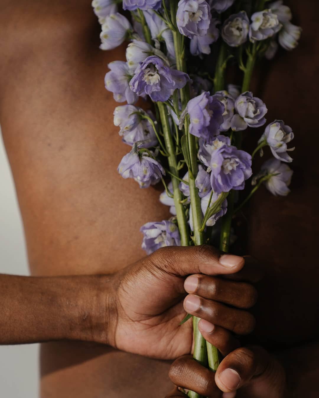 Spring is in the air so who's allergies are starting up atm??
​
​Did you know that gut issues, like intestinal permeability (AKA leaky gut), can manifest in symptoms like seasonal allergies, skin rashes and inflammation or musculoskeletal aches and p