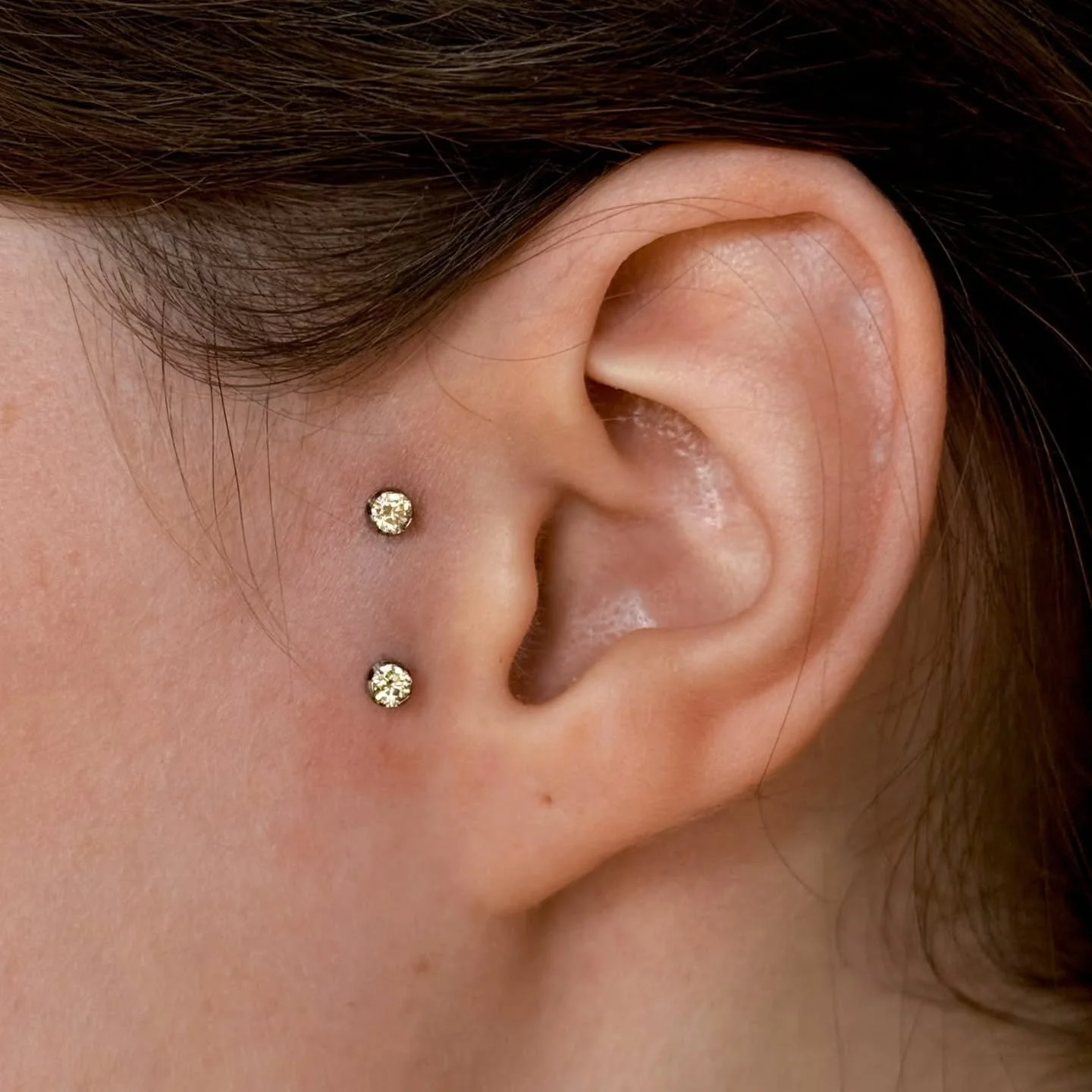 Fresh surface tragus by Clay

#safepiercing #legitbodyjewelry #supernaturalbodypiercing #kcmo #kansascitypiercing #surfacetragus #implantgrade #kcpiercing