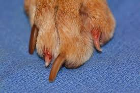 Symmetrical Lupoid Onychodystrophy (SLO) 02.jpg