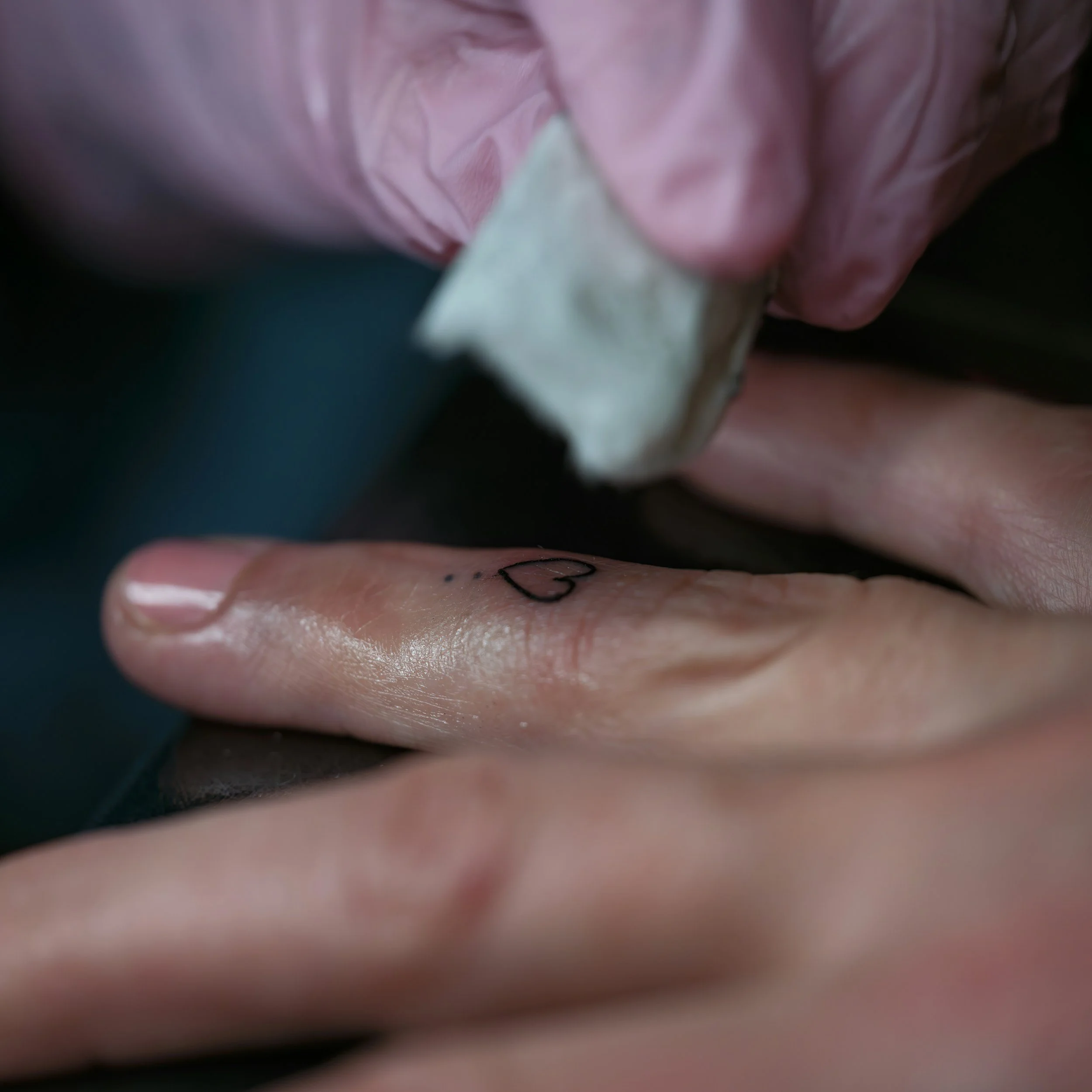 Tattoo Removal