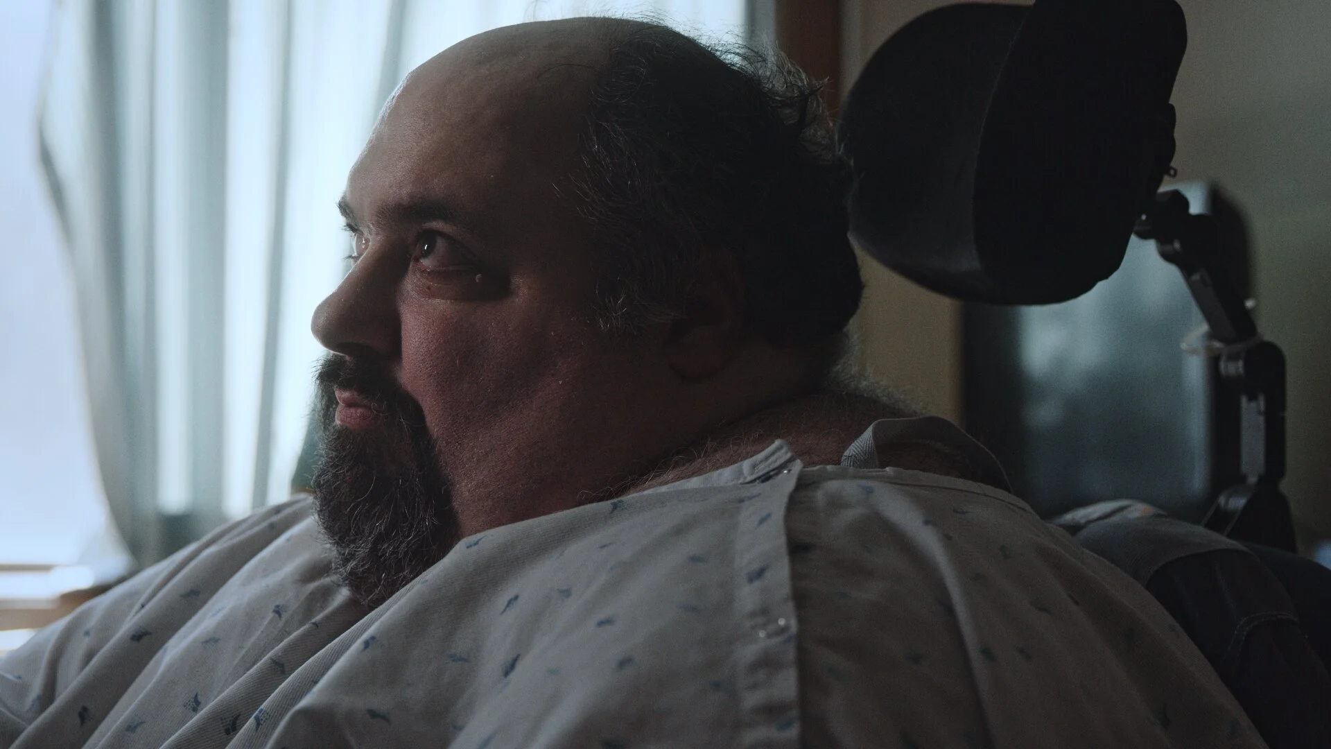 A closeup of Nick's face from the side, he is wearing a hospital gown.