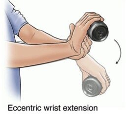 Eccentric Wrist Extension.jpg