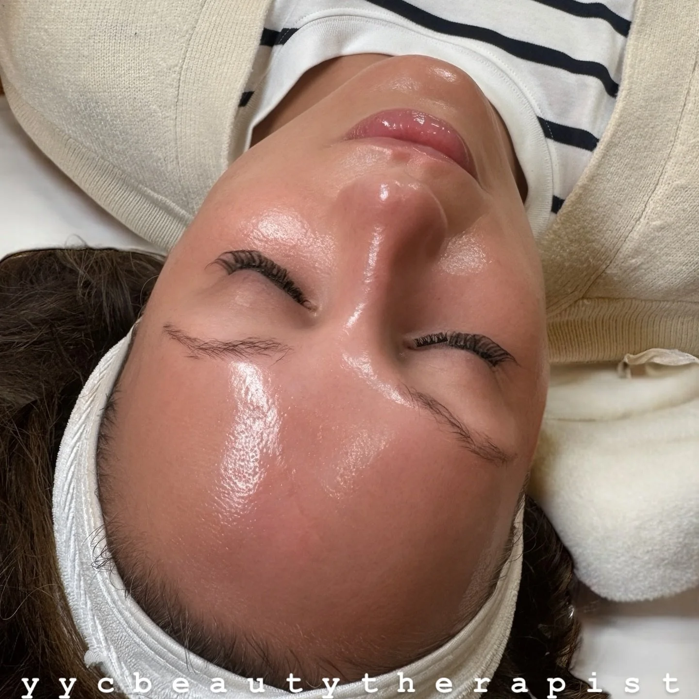 ✨GLASS SKIN✨ can you tell im obsessed with my job? 🤍 

#glassskin #dermaplane #yycbestfacials #yycfacials #yyc #yyclocal #yycnow #yycsmallbusiness #yycmedicalaesthetics #medicalaesthetician #medicalaesthetics #studiolife #skin #yycbeautytherapist #y