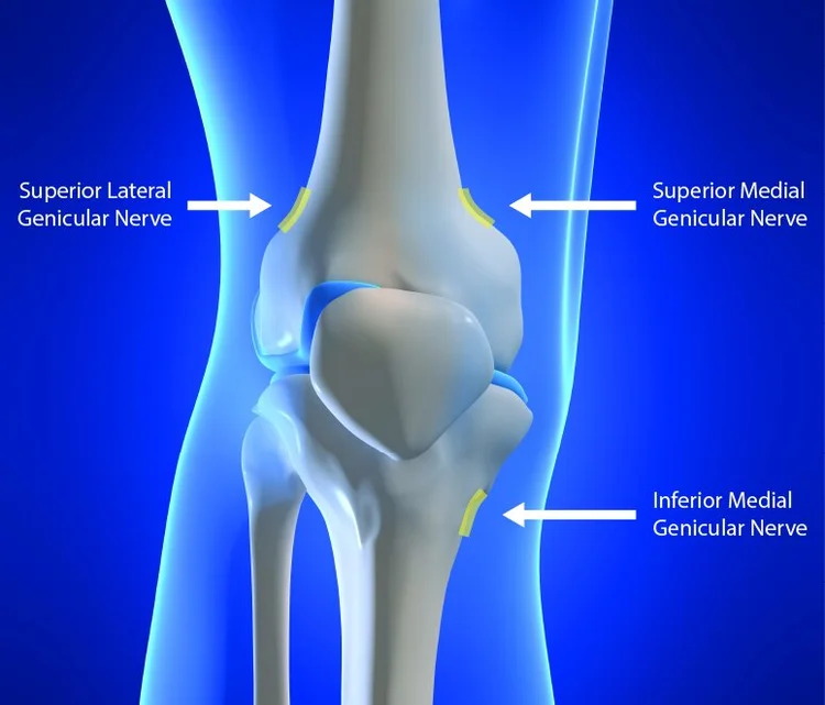 Genicular Nerve Block & Radiofrequency Ablation — EPIC PAIN MGMT (973 ...