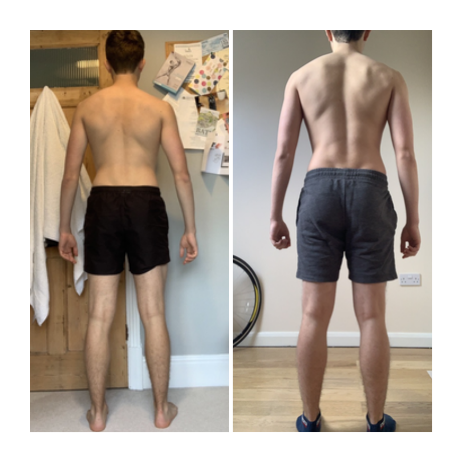 allet dancer body recomposition and transformation through targeted strength, conditioning, and physiotherapy