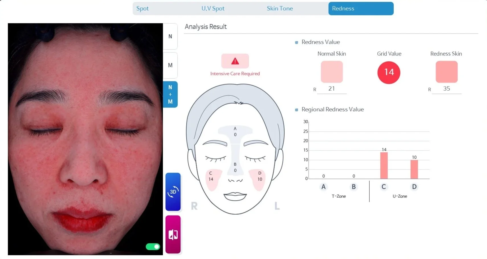 Best advanced skin analysis redness Kansas City