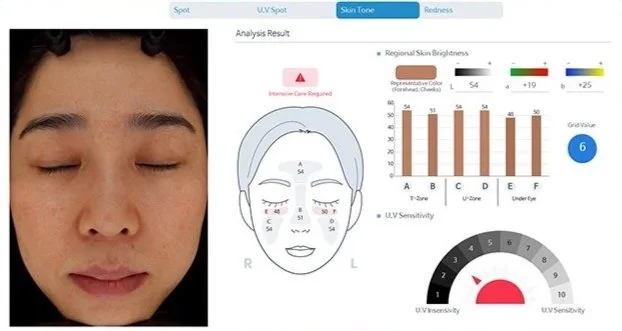 Best skin analysis skin tone and UV sensitivity Kansas City