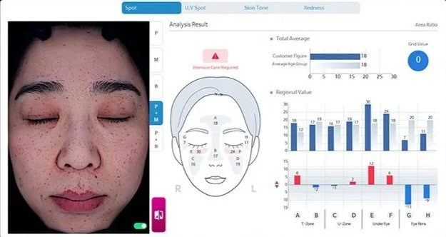 Skin analysis machine spots Kansas City