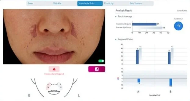 Best advanced skin consultation nasolabial fold Kansas City