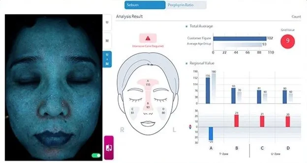 Best advanced skin analysis Sebum Kansas City