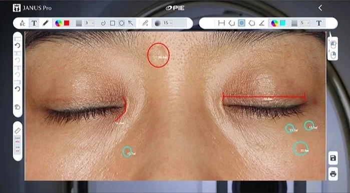 Advanced skin analysis measurement Kansas City
