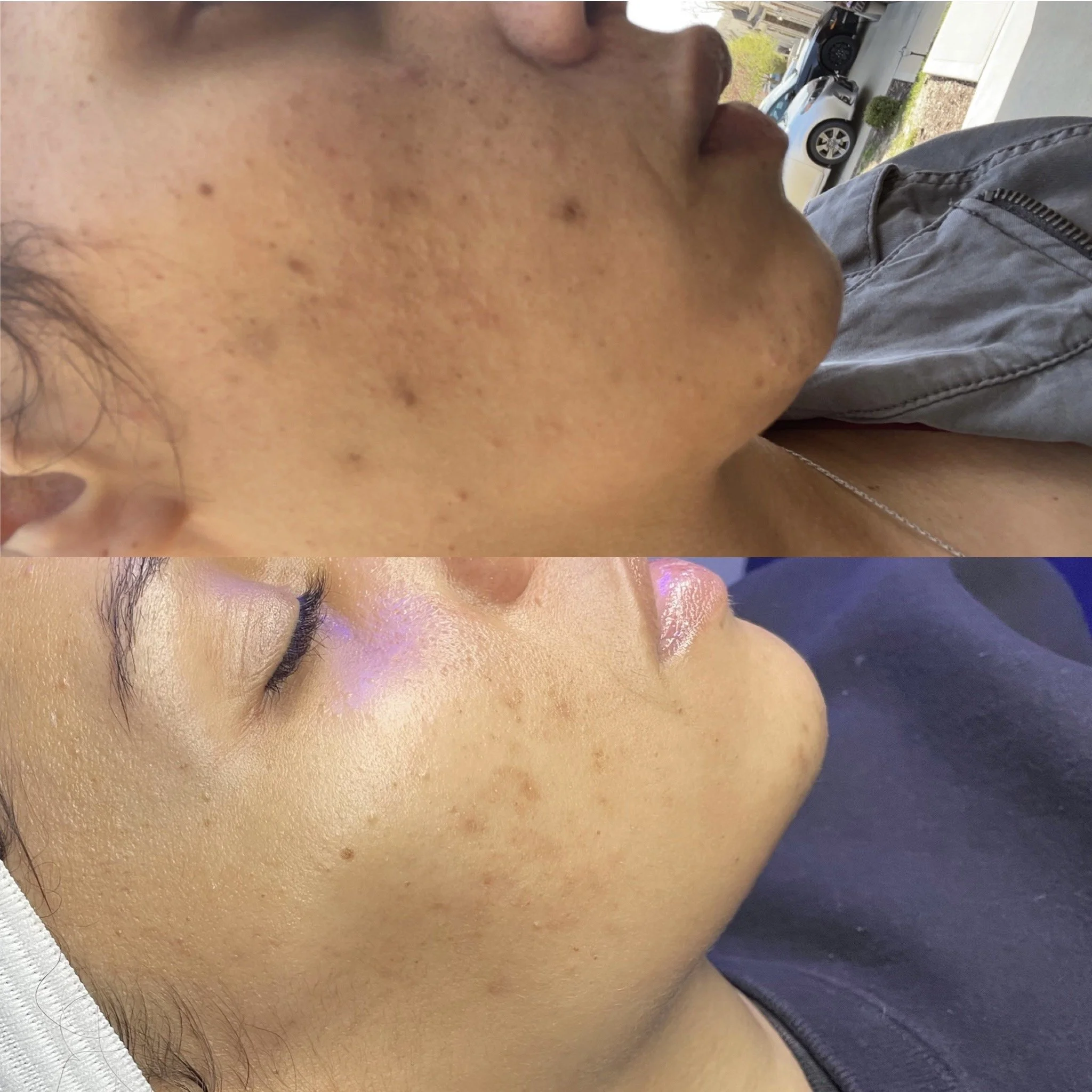 best skin care specialist in Kansas City