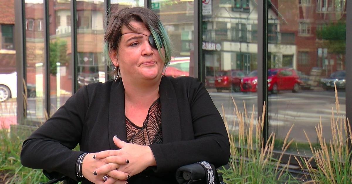 Photojournalist Injured by Minneapolis Police During 2020 Uprising Has Entered Hospice