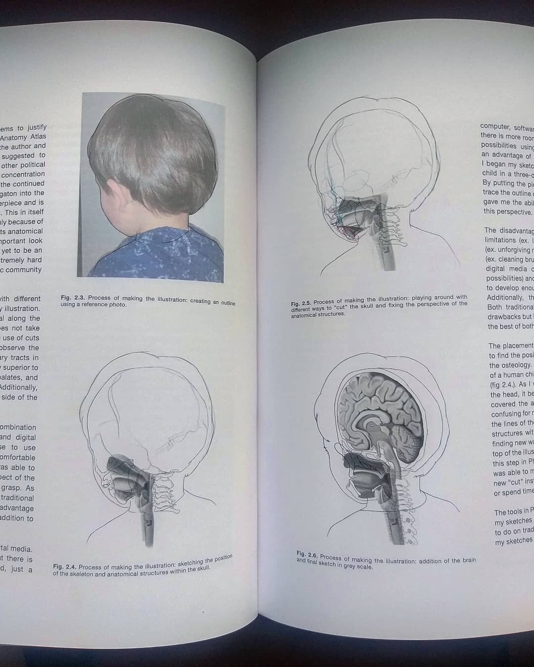 Process pictures, creating the final sketch of one of my thesis illustrations.

❀ This was particularly challenging because of the 3/4 perspective of the pharyngeal anatomy. The use of 3d models, specimens, and anatomical atlases were important in th