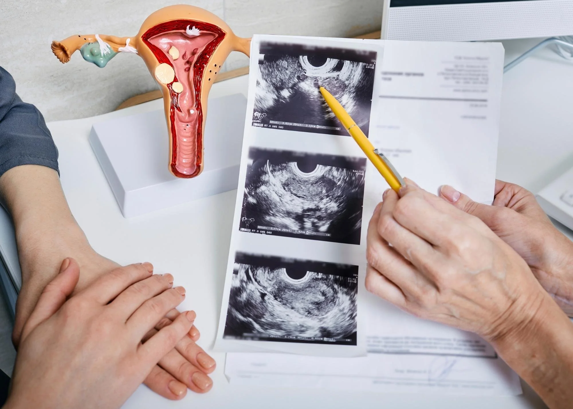 Photo of gynecological appointment going over ultrasounds