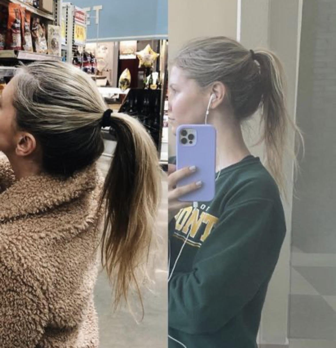 Girls who have gone through hair loss