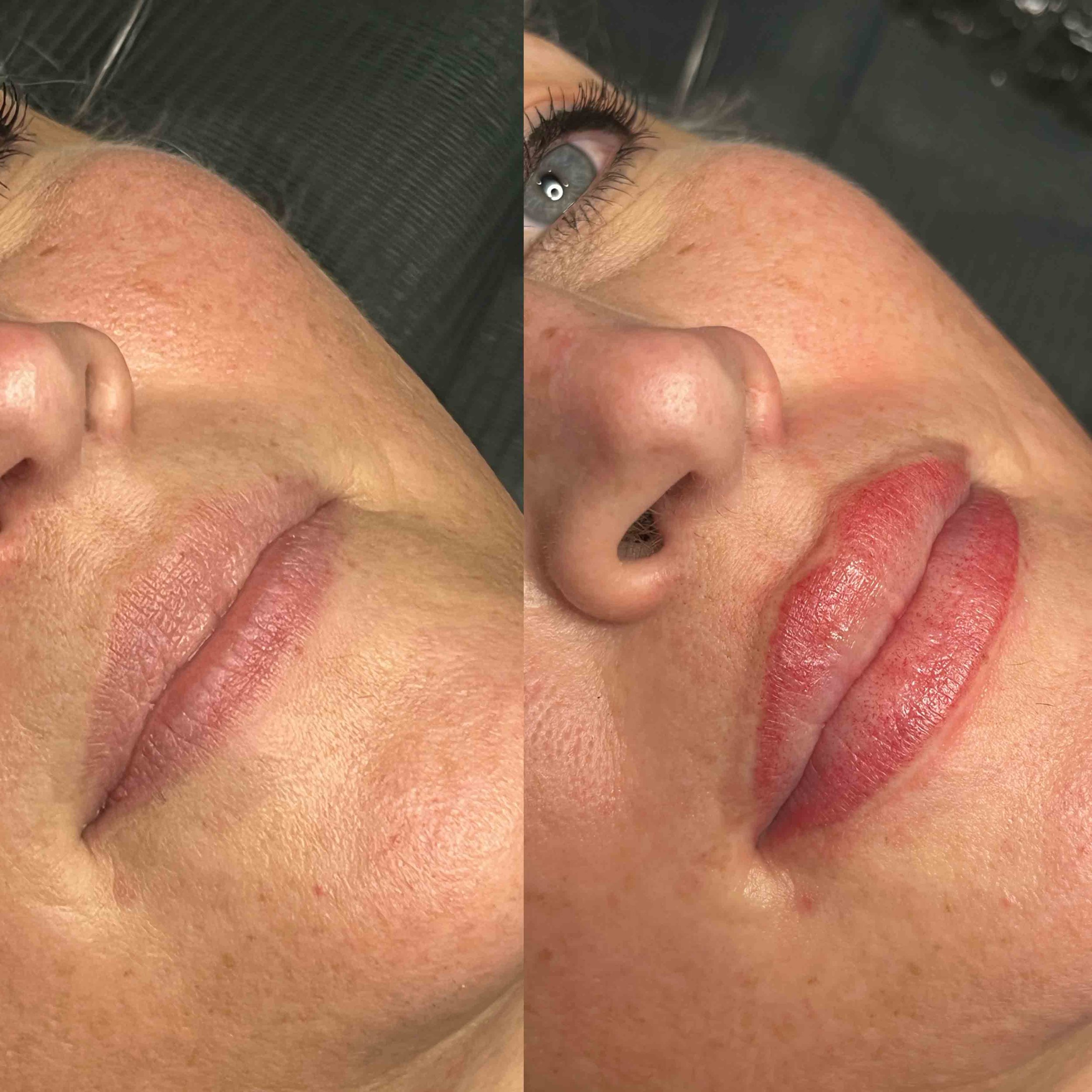 Person 4 before and after lip blush - web.jpg