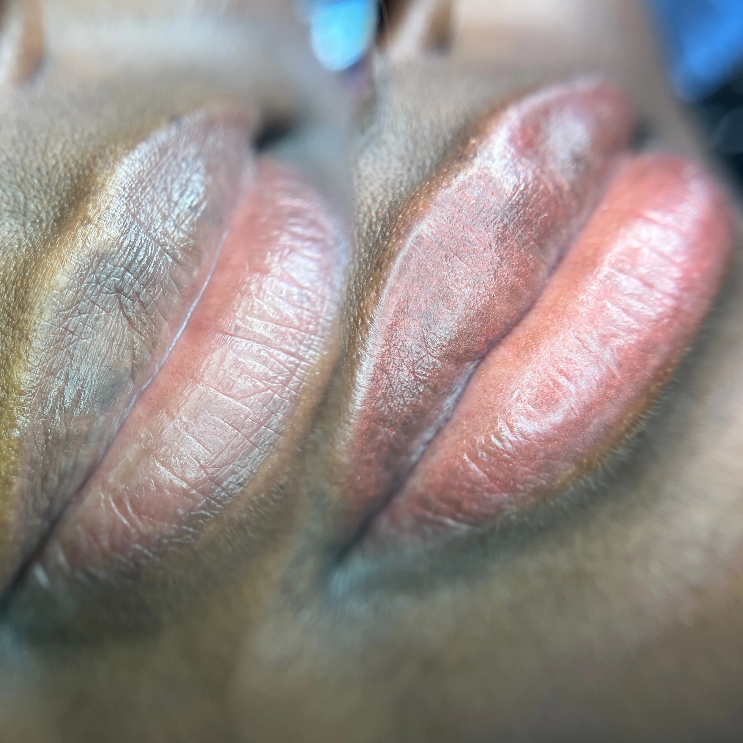 dark lip correction, dark lip neutralization