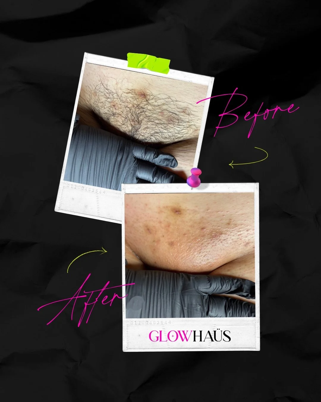 Spooky season is here and somehow Brazilian waxes are STILL being made out to be a horror movie. 👻

We&rsquo;re not gonna lie and tell you that you won&rsquo;t feel anything. You are getting hair pulled from the root, bestie! But Brazilian waxes are