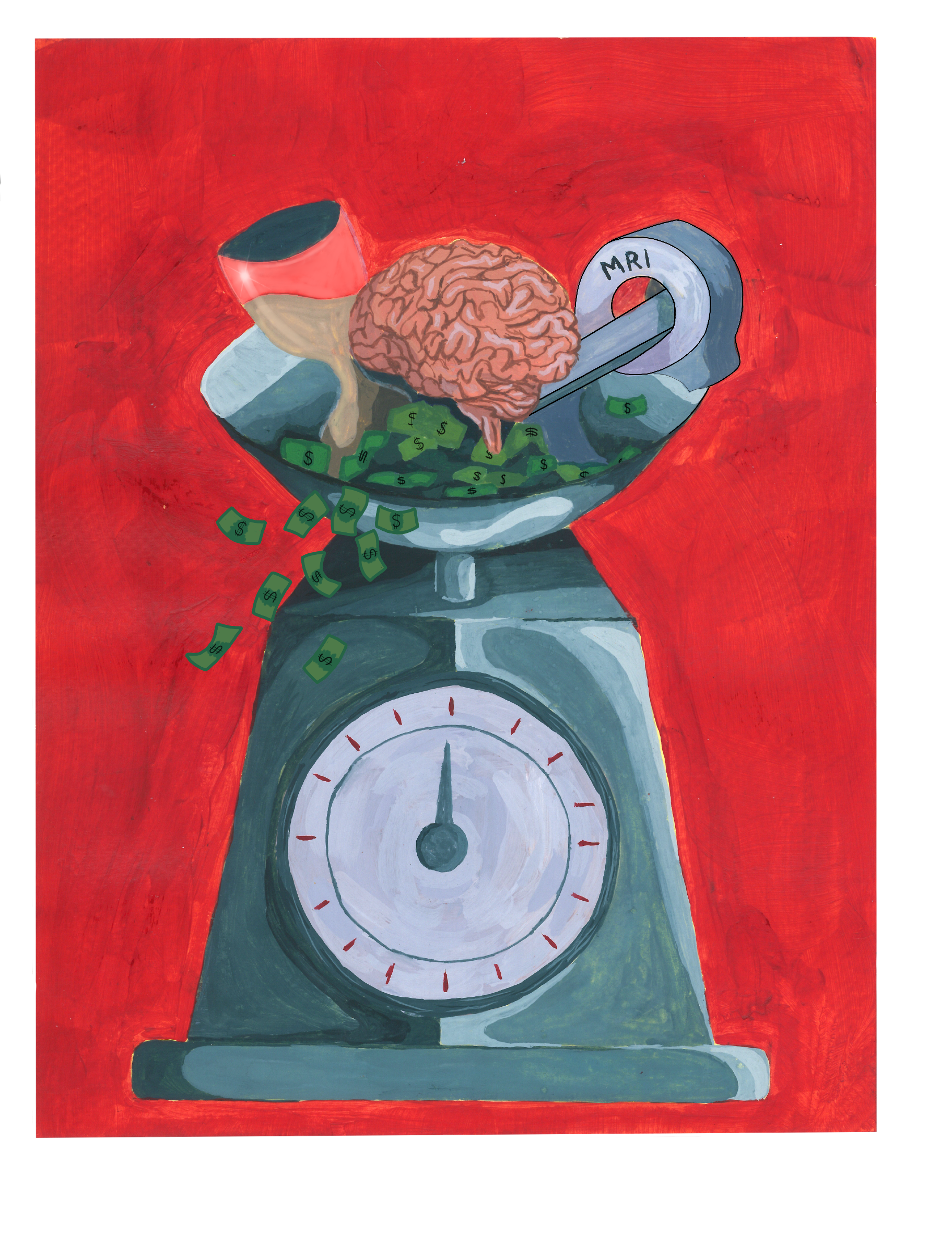 Lecanemab: A New Alzheimer’s Drug Brings Hope and Sparks Controversy