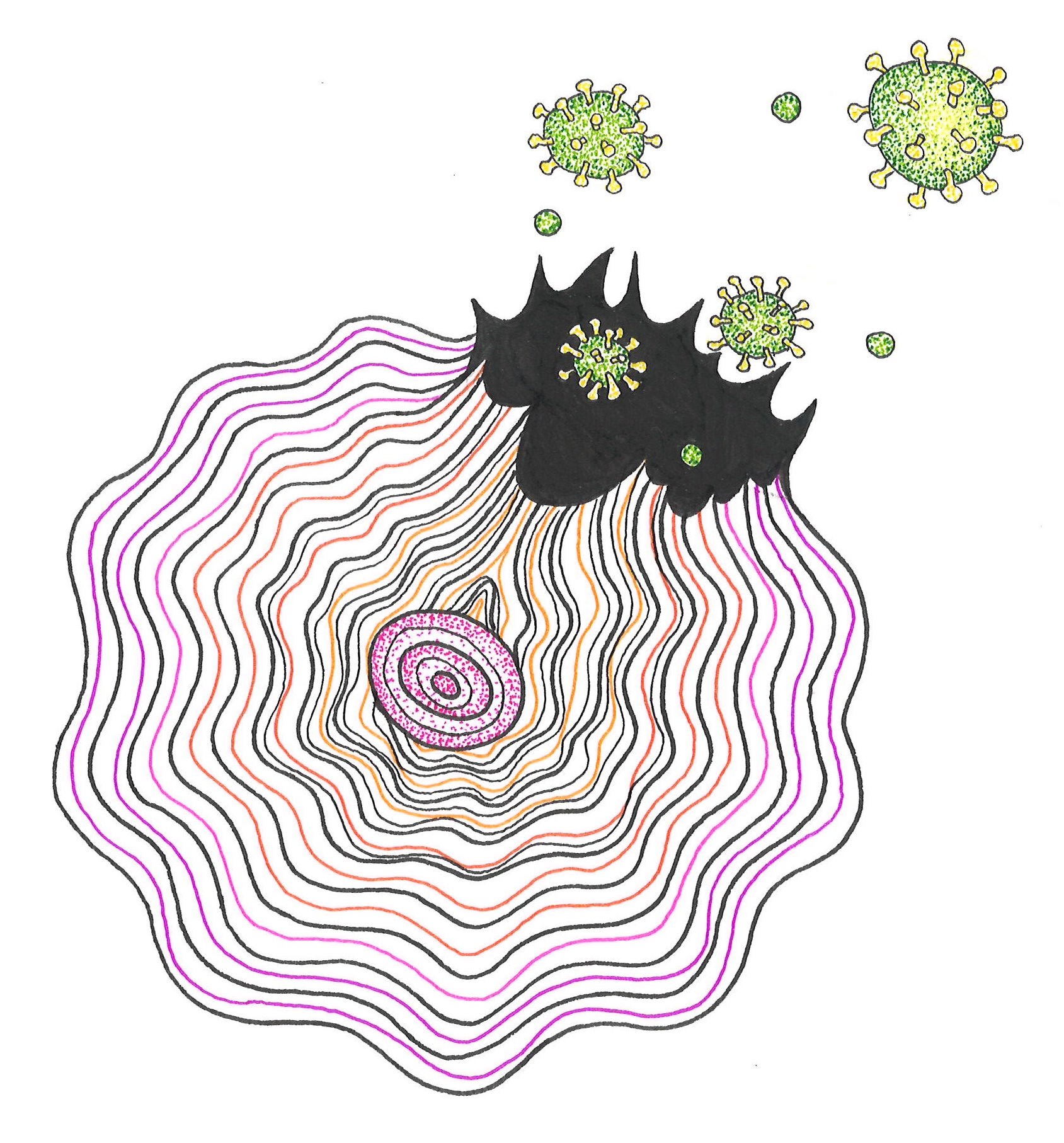 Art by: Alexandra Adsit, "Battle for the Brain: Glioblastoma's Invasion and the Immunotherapy Counterattack"