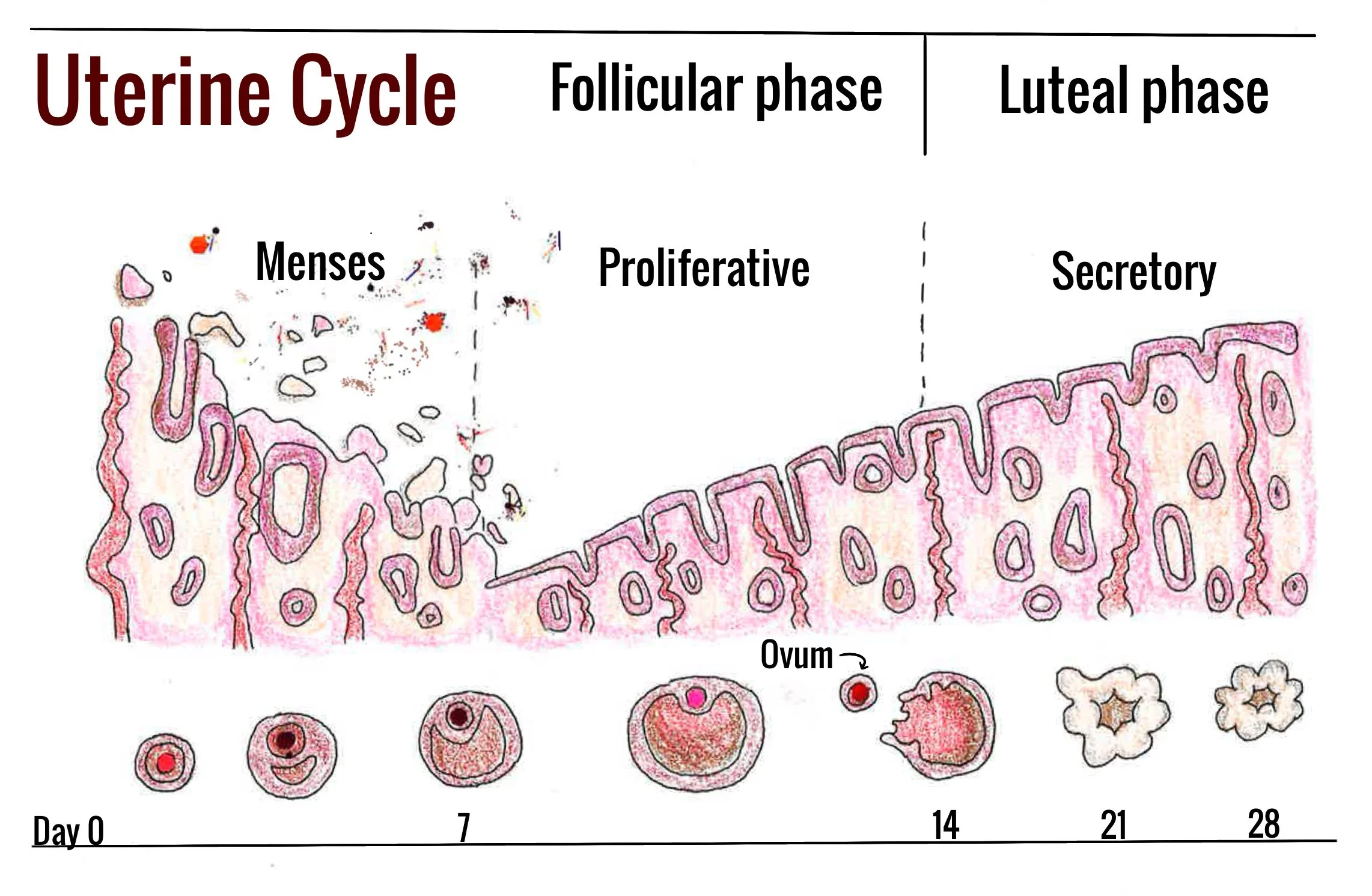 Art by Abigail Schoenecker, “Twisting The Knife: The Open Case Of Menstruation, The Brain, And The Missed Disease Of Endometriosis”