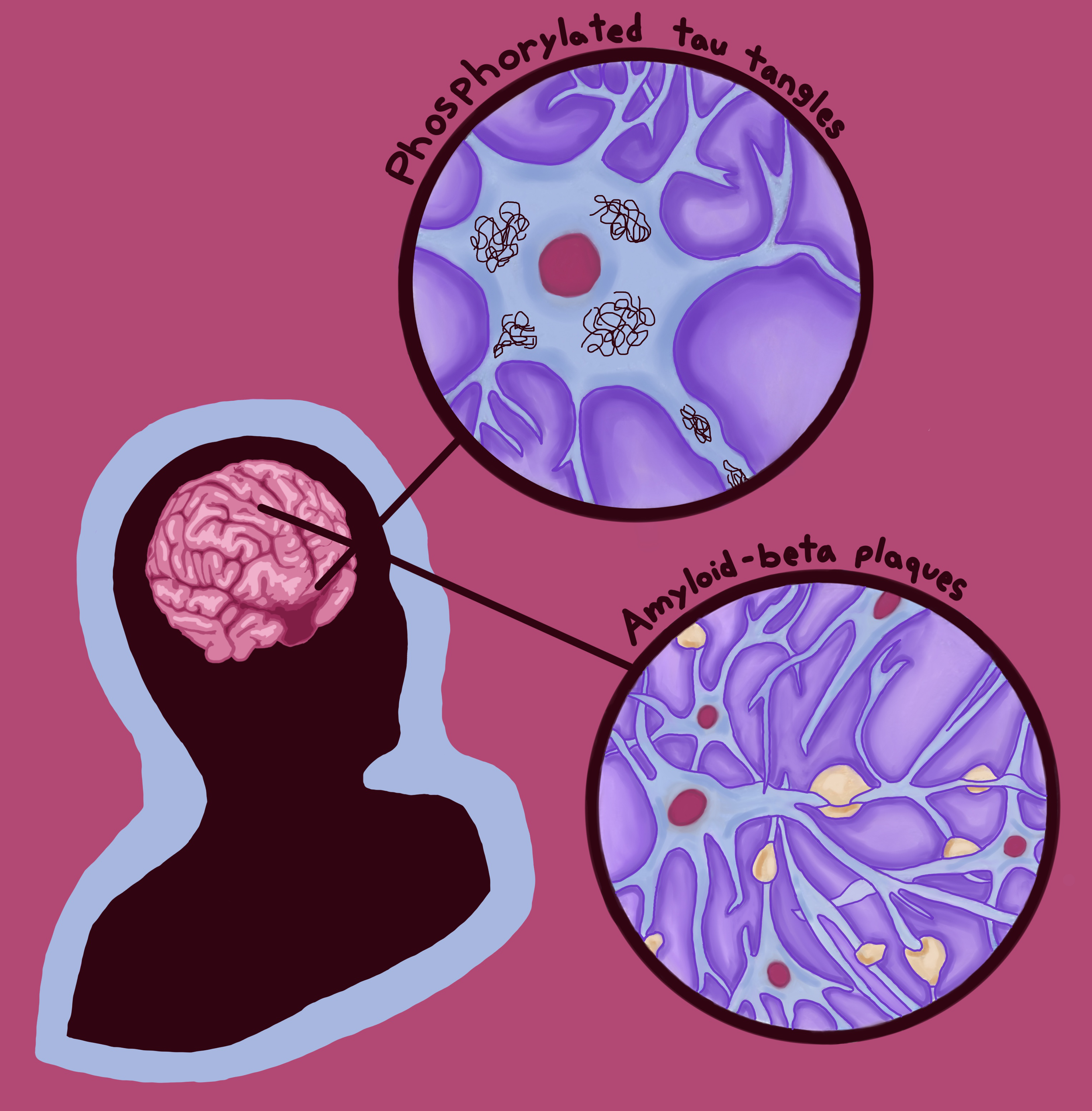 Art by: Grace Buckles, "Beyond the Billboards: Uncovering the Hidden Potentials of GLP-1 Medications"