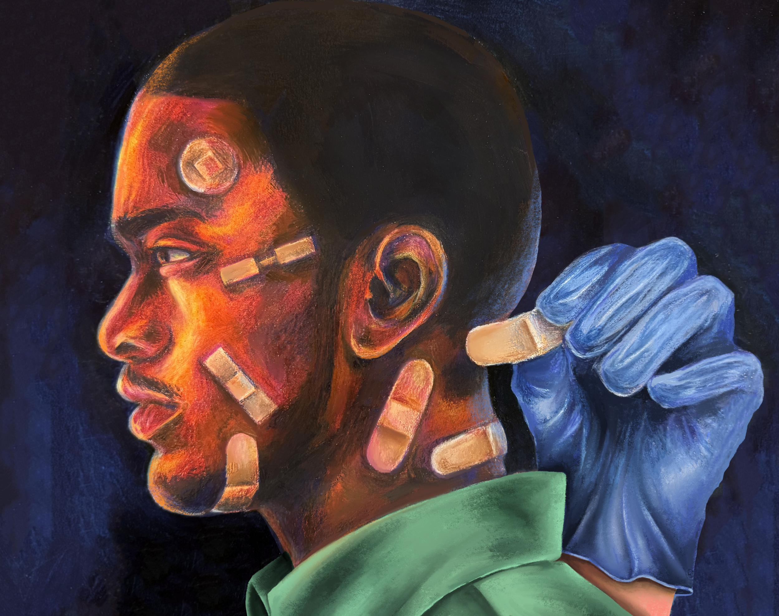 Art By: Nancy Duer, "Shades of Care: Racial Disparities in Pain Treatment"