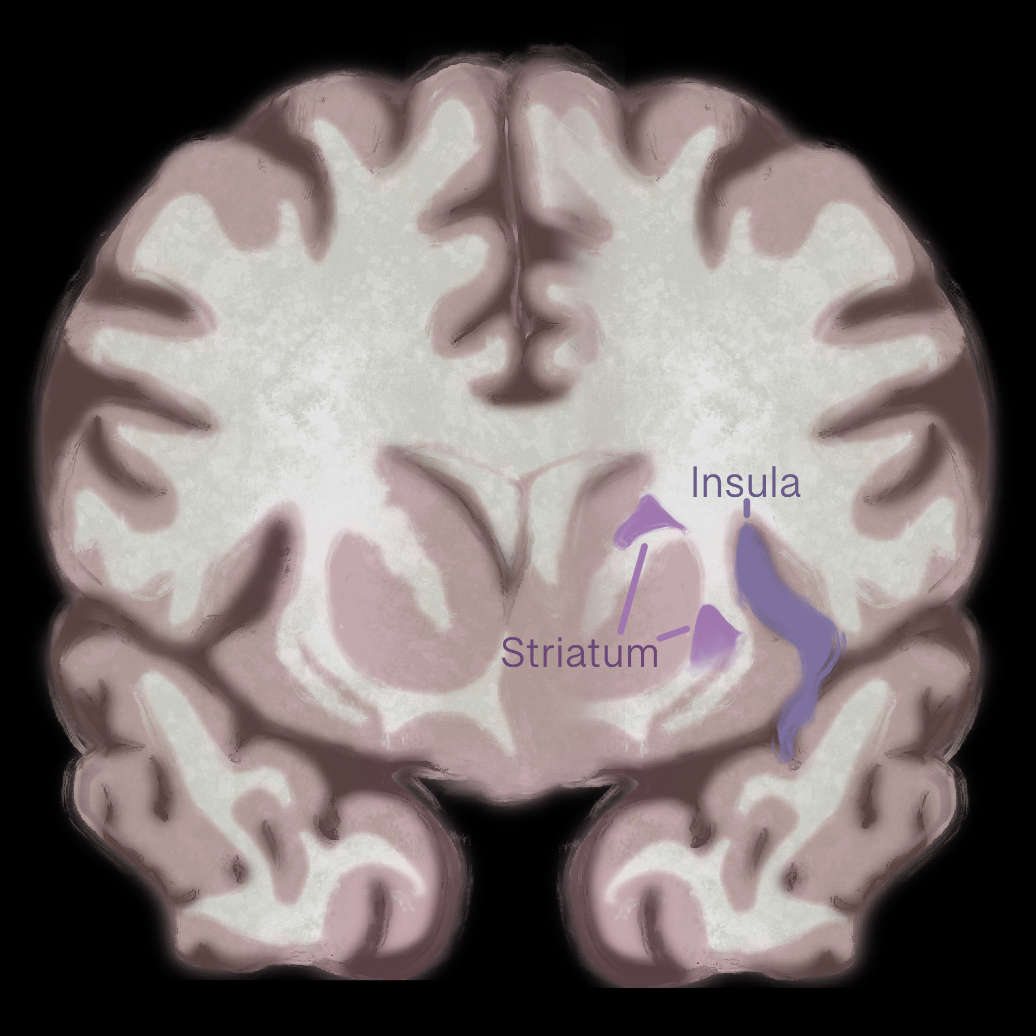 Art by: Emily Holtz, "Under the Surface: Revealing the Mechanisms Behind Eating Disorders"