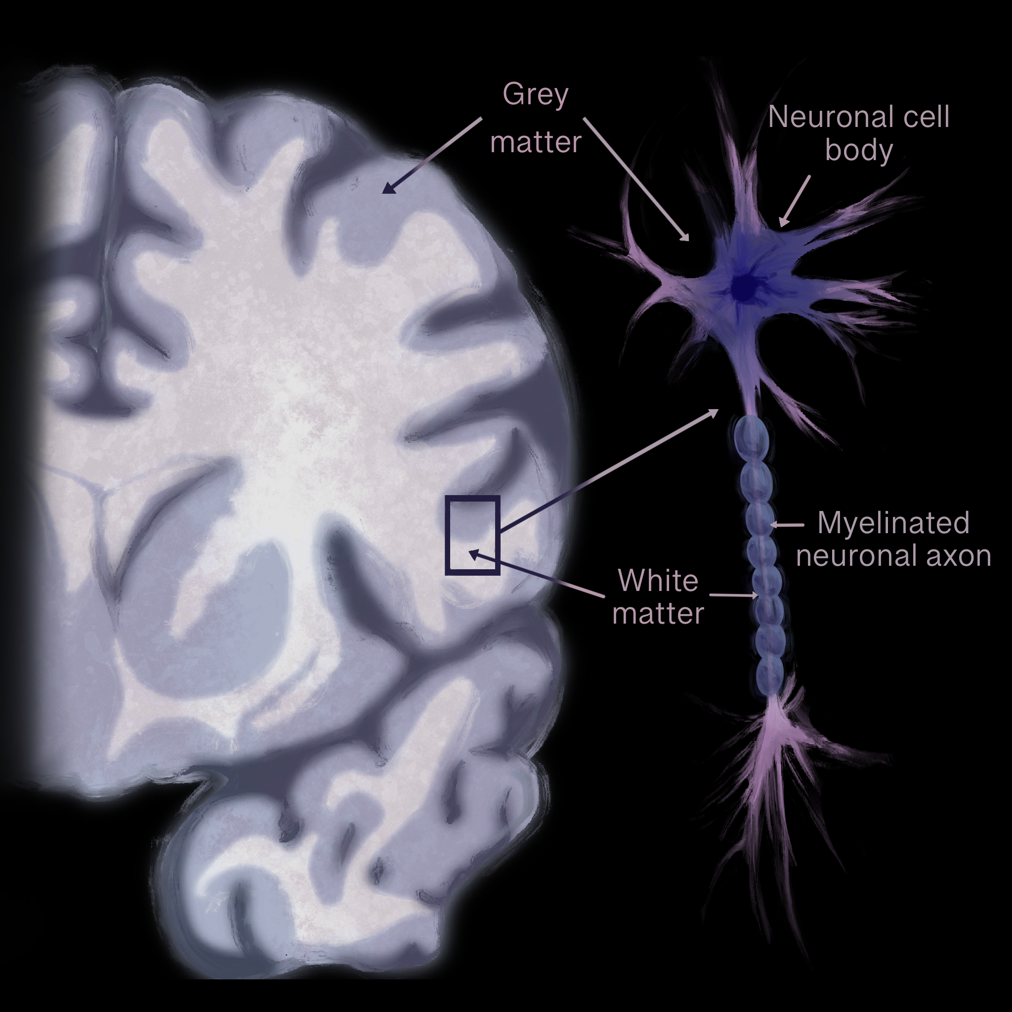 Art by: Emily Holtz, "Under the Surface: Revealing the Mechanisms Behind Eating Disorders"