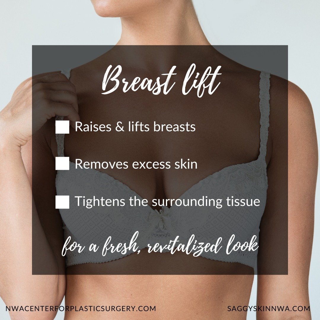 Are you happy with the size of your breasts but want to give them a lift for a fresher, younger, revitalized look? A breast lift by Board Certified Plastic Surgeon, Dr. Heath Stacey might be the procedure for you. 

Give us a call today to schedule y