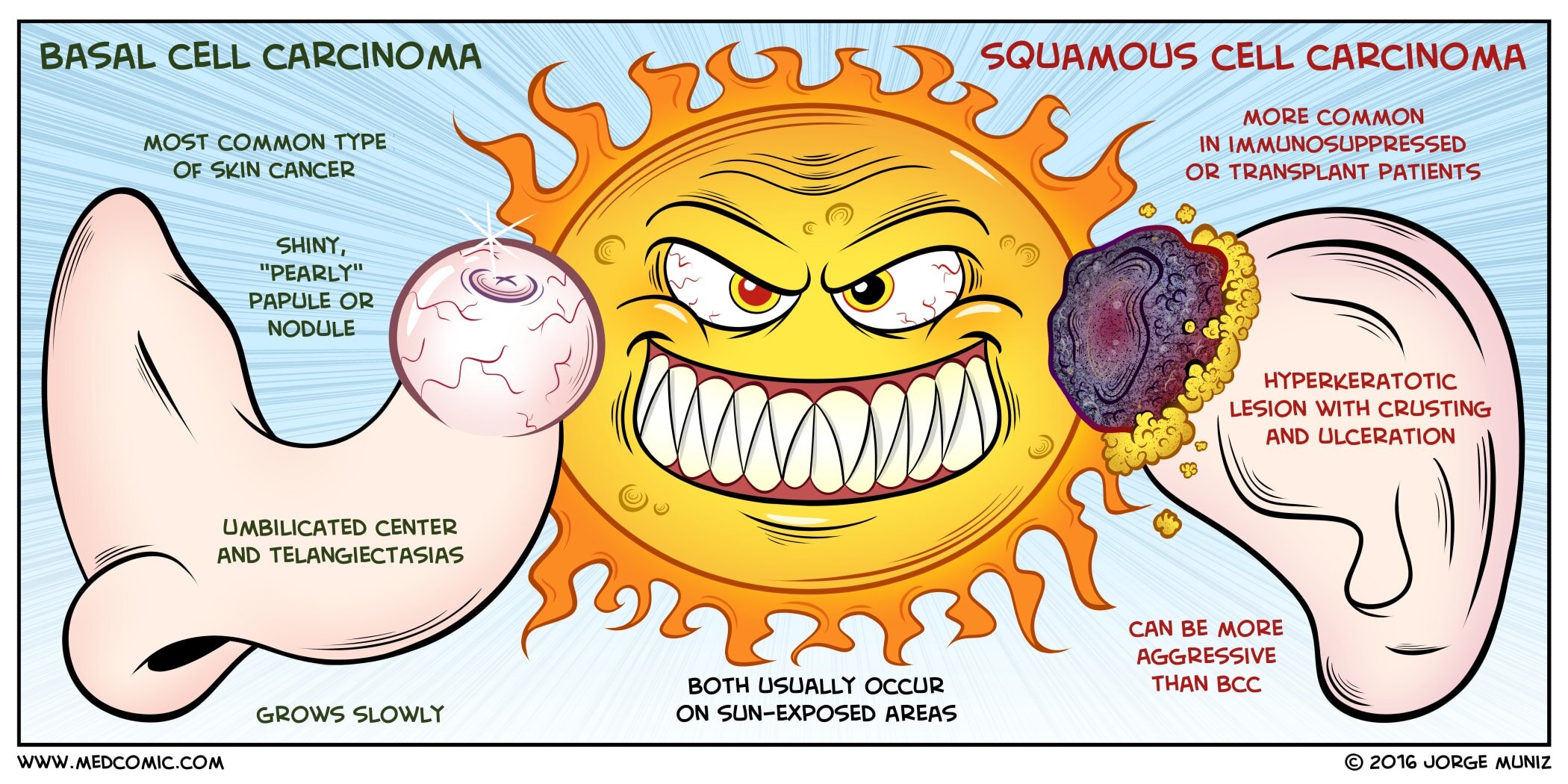 Basal Cell Carcinoma Vs Squamous Cell Carcinoma MedComic Basal Cell Carcinoma Vs Squamous Cell Carcinoma MedComic