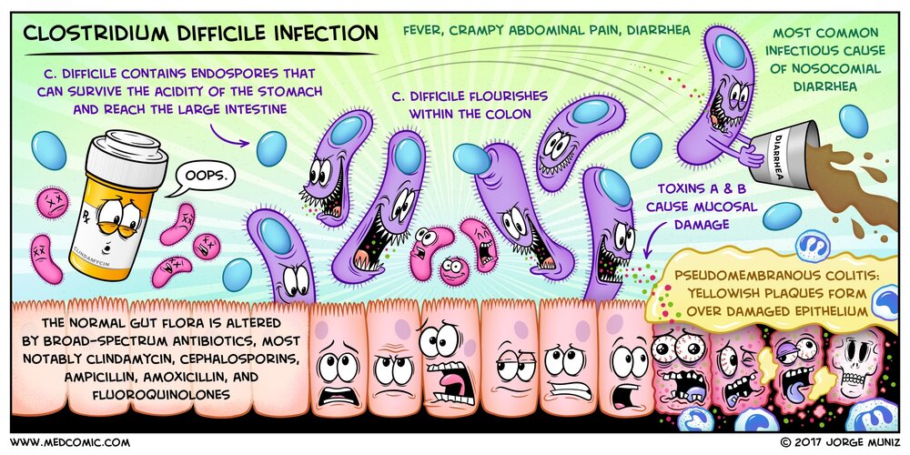 Clostridium Difficile Infection (C. Difficile Infection): Spread, Symptoms, Diagnosis, Treatment And Prevention.