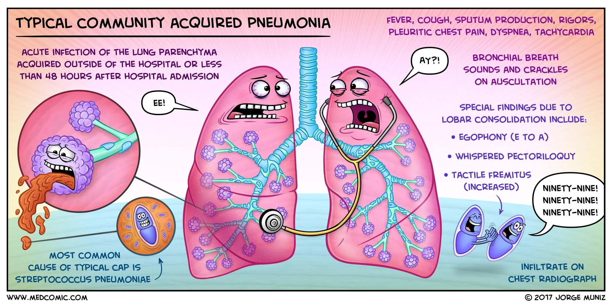 Typical Community Acquired Pneumonia Medcomic