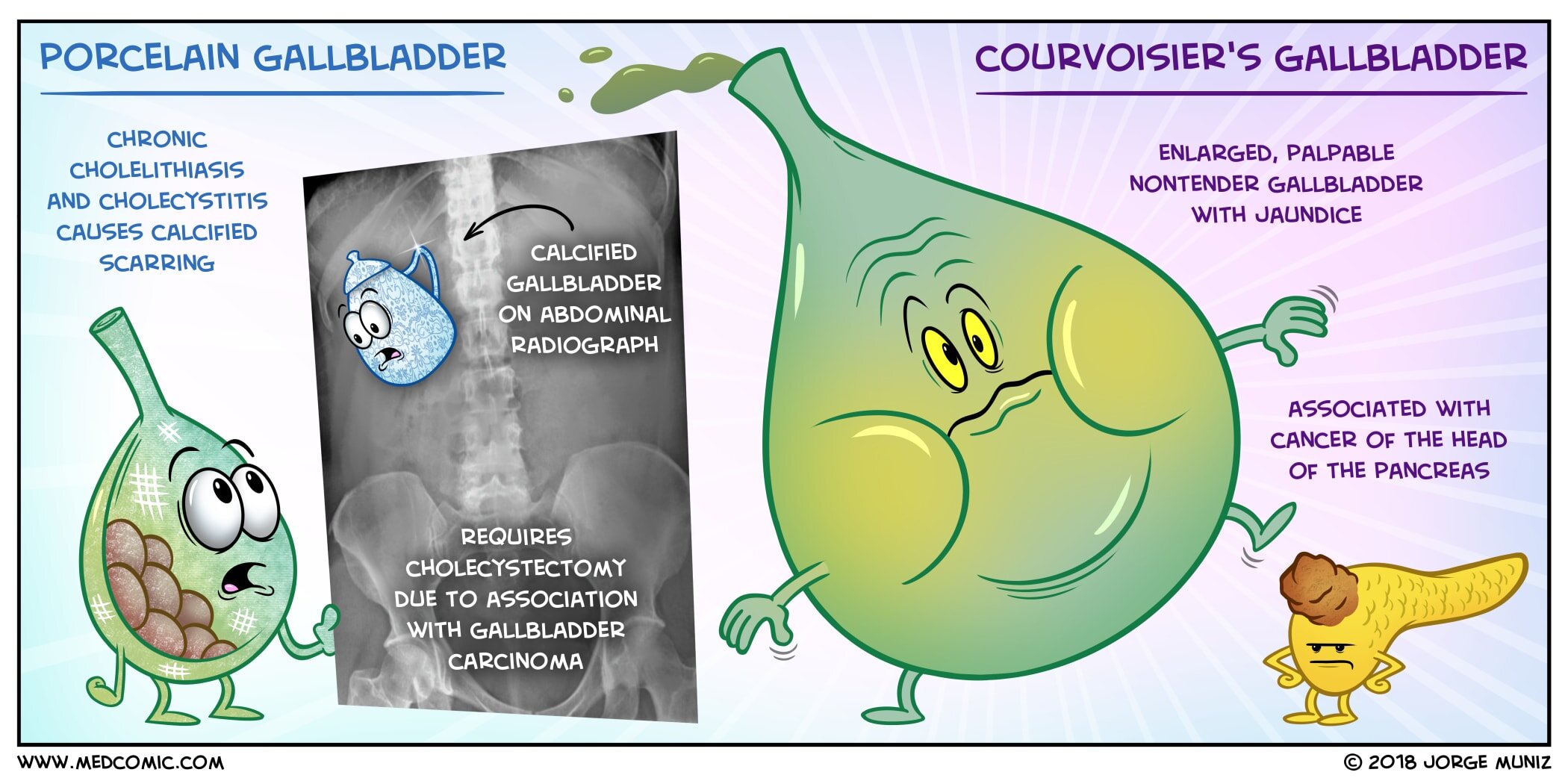 Porcelain Gallbladder vs. Courvoisier's Gallbladder — Medcomic Porcelain Gallbladder vs. Courvoisier's Gallbladder — Medcomic