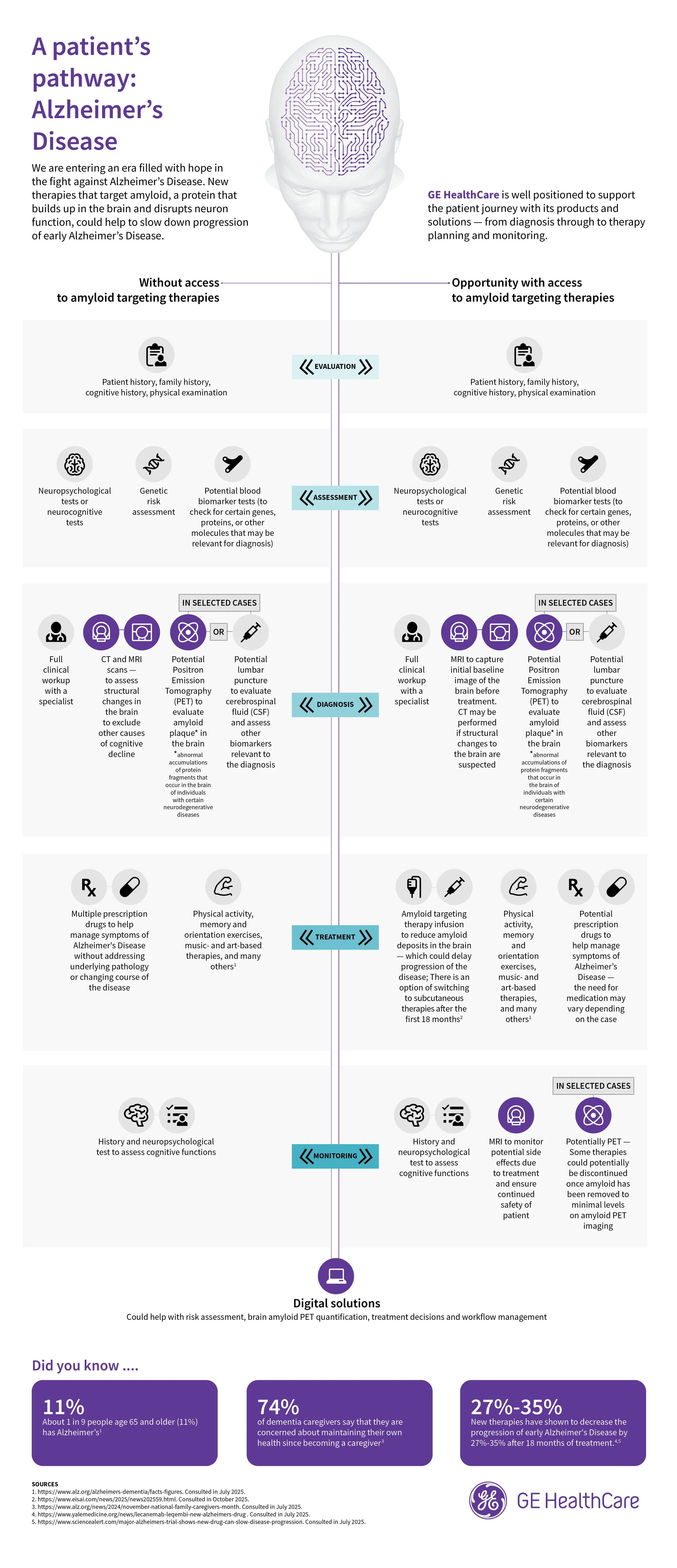 Infographic titled "A patient's pathway: Alzheimer's Disease" showing a brain with a circuit pattern. The pathway is divided into sections: evaluation, assessment, diagnosis, treatment, monitoring, and digital solutions. It includes icons and text describing steps such as patient history, neuropsychological tests, brain scans, amyloid biomarkers, and therapy options. Additional facts about Alzheimer's Disease are provided at the bottom.