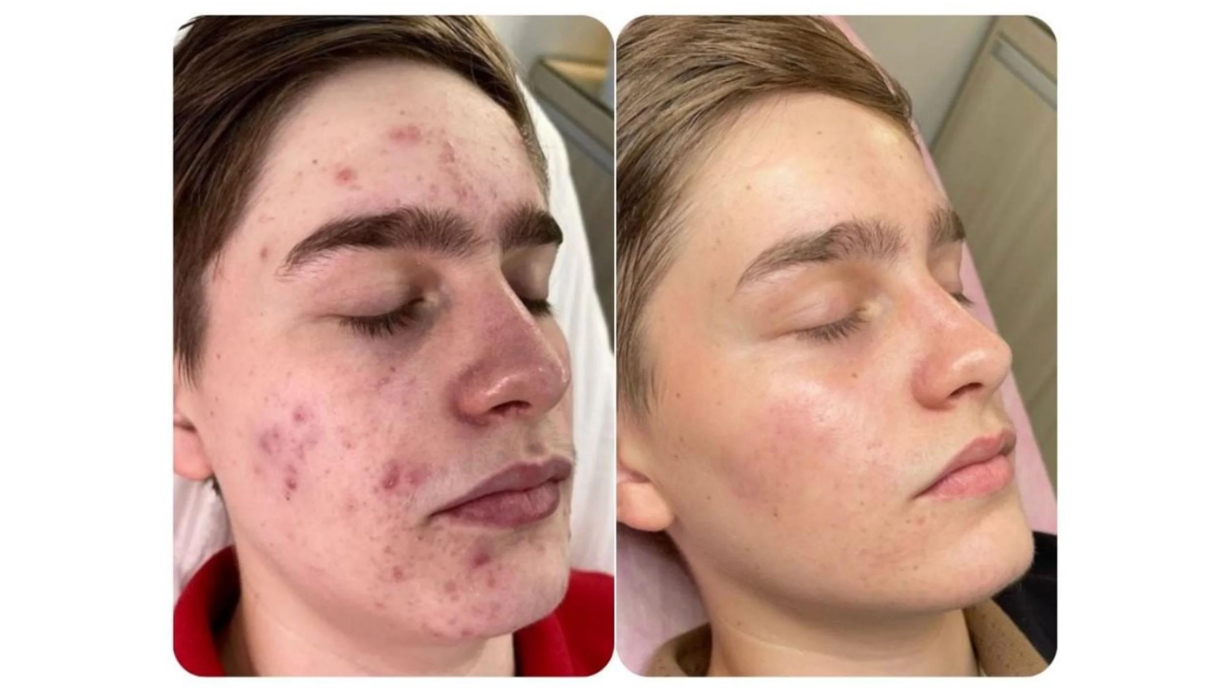 ROSE DE MER Peeling Profesional 100 natural — Centro Estético