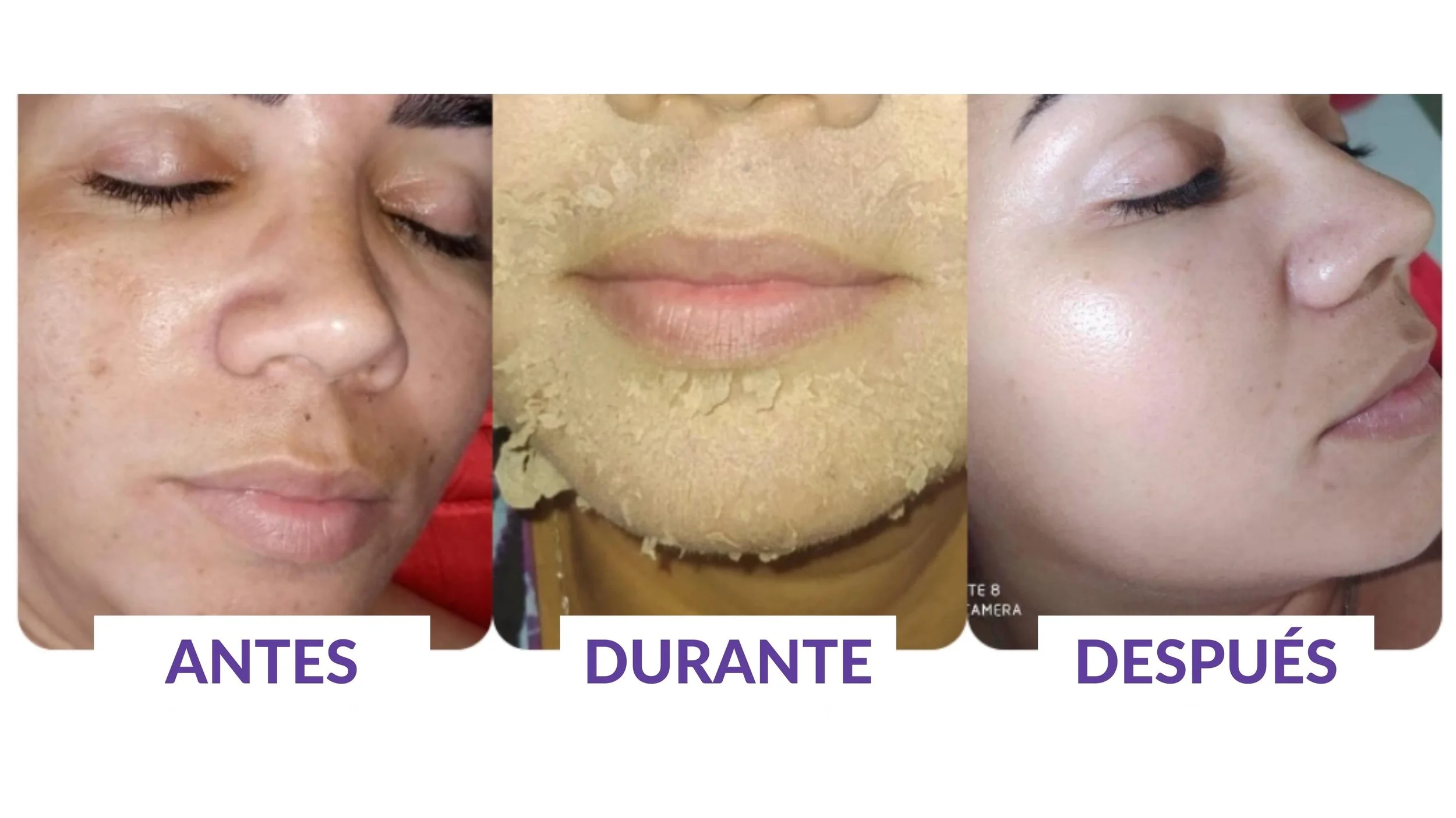 ROSE DE MER Peeling Profesional 100 natural — Centro Estético