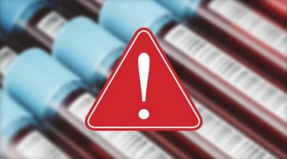 Czech Producers Issue Statement on HIV Alert, Production Hold (XBIZ)