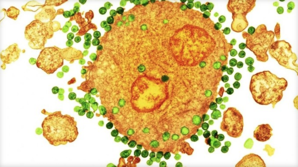 2nd HIV-Positive Patient Reportedly Cured of Infection (XBIZ)